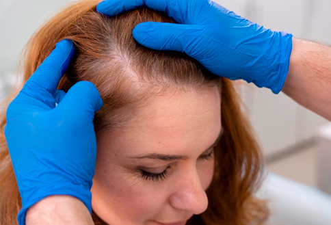 Harnessing Healing With PRP Hair Treatment